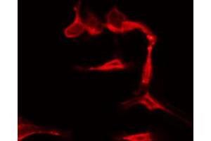 ABIN6274446 staining COLO205 by IF/ICC. (GRK7 抗体  (Internal Region))