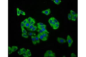 Immunofluorescence staining of HepG2 cells with ABIN7169920 at 1:166, counter-stained with DAPI. (SCN11A 抗体  (AA 403-551))