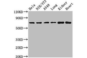 Western Blot Positive WB detected in: Hela whole cell lysate, NIH/3T3 whole cell lysate, A549 whole cell lysate, Rat lung tissue, Rat kidney tissue, Mouse heart tissue All lanes: ARHGAP18 antibody at 4. (ARHGAP18 抗体  (AA 389-577))