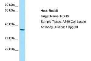 Western Blotting (WB) image for anti-Retinol Dehydrogenase 8 (RDH8) (Middle Region) antibody (ABIN2790129) (RDH8 抗体  (Middle Region))