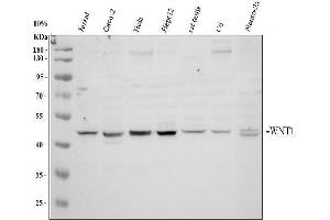 Western blot analysis of Wnt1 using anti-Wnt1 antibody (ABIN3042350).