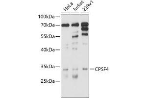 Western blot analysis of extracts of various cell lines, using CPSF4 antibody (ABIN6130128, ABIN6138972, ABIN6138973 and ABIN6214478) at 1:1000 dilution. (CPSF4 抗体  (AA 1-244))
