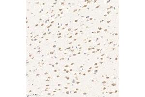 Immunohistochemistry of paraffin embedded mouse brain using AZI2 (ABIN7072856) at dilution of 1:650 (300x lens) (AZI2 抗体)