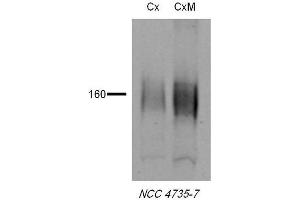 Western blot analysis of Rat tissue lysates showing detection of NCC protein using Rabbit Anti-NCC Polyclonal Antibody . (SLC12A3 抗体  (AA 74-95) (PE))