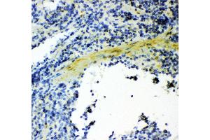 Anti- Gelsolin antibody, IHC(P) IHC(P): Mouse Spleen Tissue (Gelsolin 抗体  (AA 580-782))