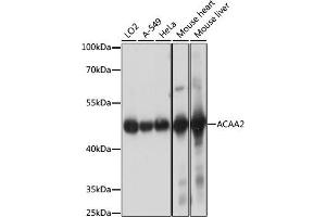 Western blot analysis of extracts of various cell lines, using  antibody (ABIN7265368) at 1:1000 dilution. (ACAA2 抗体  (AA 1-250))