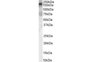 Image no. 1 for anti-rho Guanine Nucleotide Exchange Factor (GEF) 5 (ARHGEF5) (Internal Region) antibody (ABIN374647) (ARHGEF5 抗体  (Internal Region))