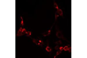 ABIN6274871 staining NIH-3T3 cells by IF/ICC. (Ataxin 2-Like 抗体  (Internal Region))