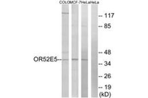 Western blot analysis of extracts from COLO/MCF-7/HeLa cells, using OR52E5 Antibody. (OR52E5 抗体  (AA 199-248))