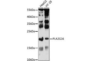 Western blot analysis of extracts of various cell lines, using PLG16 antibody (ABIN7267786) at 1:1000 dilution. (PLA2G16 抗体  (AA 68-162))