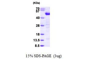 SDS-PAGE (SDS) image for Testis Derived Transcript (3 LIM Domains) (TES) (AA 1-421) protein (His tag) (ABIN667812) (TES Protein (AA 1-421) (His tag))