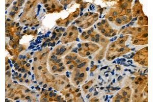 ABIN6264138 and ABIN6273148 at 1/100 staining Rat kidney tissue by IHC-P. (PER2 抗体  (Internal Region))