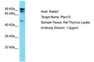 Image no. 1 for anti-Protein Tyrosine Phosphatase G1 (PTPN12) (AA 591-640) antibody (ABIN6750360) (PTPN12 抗体  (AA 591-640))