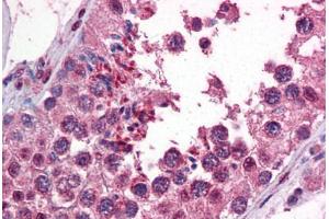 Human Testis: Formalin-Fixed, Paraffin-Embedded (FFPE) (CAMK2B 抗体  (AA 1-504))
