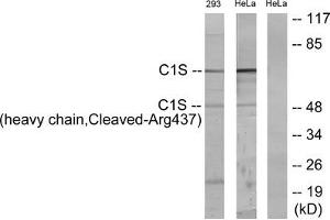 Western blot analysis of extracts from 293 cells treated with etoposide (25uM, 1hour) and HeLa cells treated with etoposide (25uM, 24hours), using C1S (heavy chain, Cleaved-Arg437) antibody. (C1S 抗体  (Cleaved-Arg437))