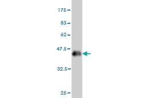 Western Blot detection against Immunogen (36. (CSNK1G1 抗体  (AA 293-393))