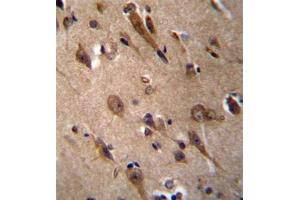 Immunohistochemistry (Paraffin-embedded Sections) (IHC (p)) image for anti-Resistance To Inhibitors of Cholinesterase 3 Homolog (RIC3) (AA 319-348), (C-Term) antibody (ABIN954548)