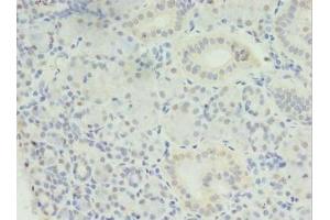 Immunohistochemistry of paraffin-embedded human pancreatic tissue using ABIN7159152 at dilution of 1:100 (MED27 抗体  (AA 67-165))