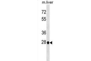 Western Blotting (WB) image for anti-Homeobox B5 (HOXB5) antibody (ABIN2999364) (HOXB5 抗体)
