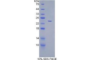 SDS-PAGE analysis of Human CDC25B Protein. (CDC25B 蛋白)