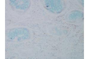 Immunohistochemistry analysis using Mouse Anti-Nitrotyrosine Monoclonal Antibody, Clone 39B6 . (Nitrotyrosine 抗体  (Biotin))