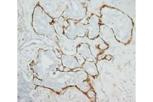MMP2 Polyclonal Antibody (MMP2 抗体  (C-Term))