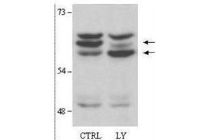 Western Blotting (WB) image for anti-V-Akt Murine Thymoma Viral Oncogene Homolog 2 (AKT2) (AA 450-475) antibody (ABIN94790)