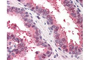Anti-RAD23B antibody IHC of human prostate. (RAD23B 抗体  (AA 163-176))
