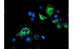 Image no. 3 for anti-Ubiquinol-Cytochrome C Reductase Core Protein I (UQCRC1) (AA 46-305) antibody (ABIN1491532) (UQCRC1 抗体  (AA 46-305))