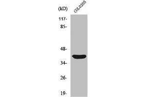 Western Blot analysis of COLO205 cells using Siah-2 Polyclonal Antibody (SIAH2 抗体  (C-Term))