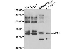 Western blot analysis of extracts of various cell lines, using AKT1 antibody (ABIN5974372). (AKT1 抗体)