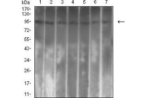 Western Blotting (WB) image for anti-Colony Stimulating Factor 2 Receptor, Beta (CSF2RB) (AA 17-149) antibody (ABIN7193500)