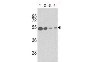 Western blot analysis of b-Tubulin antibody and (1) mouse brain tissue, (2) Y79, (3) CEM and (4) 293 lysate. (TUBB1 抗体)