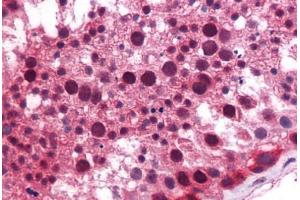 Human Testis: Formalin-Fixed, Paraffin-Embedded (FFPE) (KLF9 抗体  (AA 38-87))