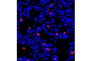 Immunofluorescent analysis of paraffin embedded mouse lung using S100A9 (ABIN7075497) at dilution of 1: 900 (S100A9 抗体)