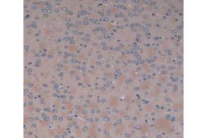 DAB staining on IHC-P; Samples: Rat Brain Tissue. (SERPINA6 抗体  (AA 173-344))