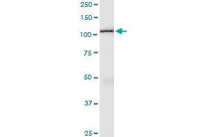 Immunoprecipitation of AMOTL1 transfected lysate using anti-AMOTL1 MaxPab rabbit polyclonal antibody and Protein A Magnetic Bead , and immunoblotted with AMOTL1 purified MaxPab mouse polyclonal antibody (B01P) . (AMOTL1 抗体  (AA 1-956))