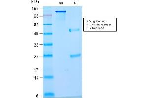 SDS-PAGE Analysis Purified Pan-Nuclear Antigen Monoclonal Antibody (NM2984R). (Recombinant Nuclear Antigen (Pan-Nuclear Marker) 抗体)