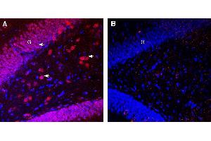 Expression of Pannexin 1 in rat hippocampus. (PANX1 抗体  (Intracellular))