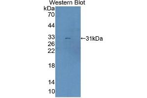 Western blot analysis of the recombinant protein. (BCOR 抗体  (AA 1553-1755))