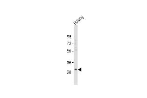 Anti-KLK6 Antibody (A13)at 1:2000 dilution + human lung lysates Lysates/proteins at 20 μg per lane. (Kallikrein 6 抗体  (N-Term))