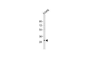 Anti-KLK6 Antibody (A13)at 1:2000 dilution + human lung lysates Lysates/proteins at 20 μg per lane. (Kallikrein 6 抗体  (N-Term))