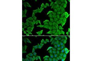 Immunofluorescence analysis of U2OS cells using SMYD2 Polyclonal Antibody (SMYD2A 抗体)