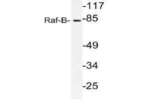 Western blot (WB) analysis of Raf-B antibody in extracts from 293 cells. (BRAF 抗体)