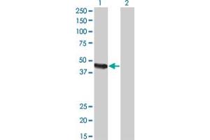 Western Blot analysis of CPA2 expression in transfected 293T cell line by CPA2 monoclonal antibody (M02), clone 2E11. (Carboxypeptidase A2 抗体  (AA 117-206))