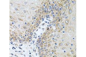 Immunohistochemistry of paraffin-embedded Human esophagus using CPM Polyclonal Antibody at dilution of 1:100 (40x lens). (CPM 抗体)