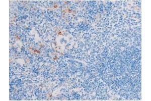 ABIN6255701 and ABIN6267554 at 1/200 staining Mouse spleen tissue sections by IHC-P. (LIM Domain Kinase 1 抗体  (pThr508))