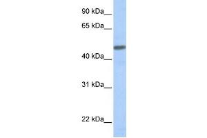 Western Blotting (WB) image for anti-Calcitonin Receptor-Like (CALCRL) antibody (ABIN2458637) (CALCRL 抗体)