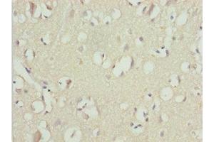 Immunohistochemistry of paraffin-embedded human brain tissue using ABIN7174528 at dilution of 1:100 (UBA6 抗体  (AA 1-260))