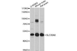 Western blot analysis of extracts of various cell lines, using SLC30A6 Antibody (ABIN4905198) at 1:3000 dilution. (SLC30A6 抗体)